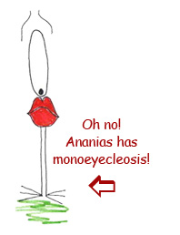 ananias has monoeyecleosis!